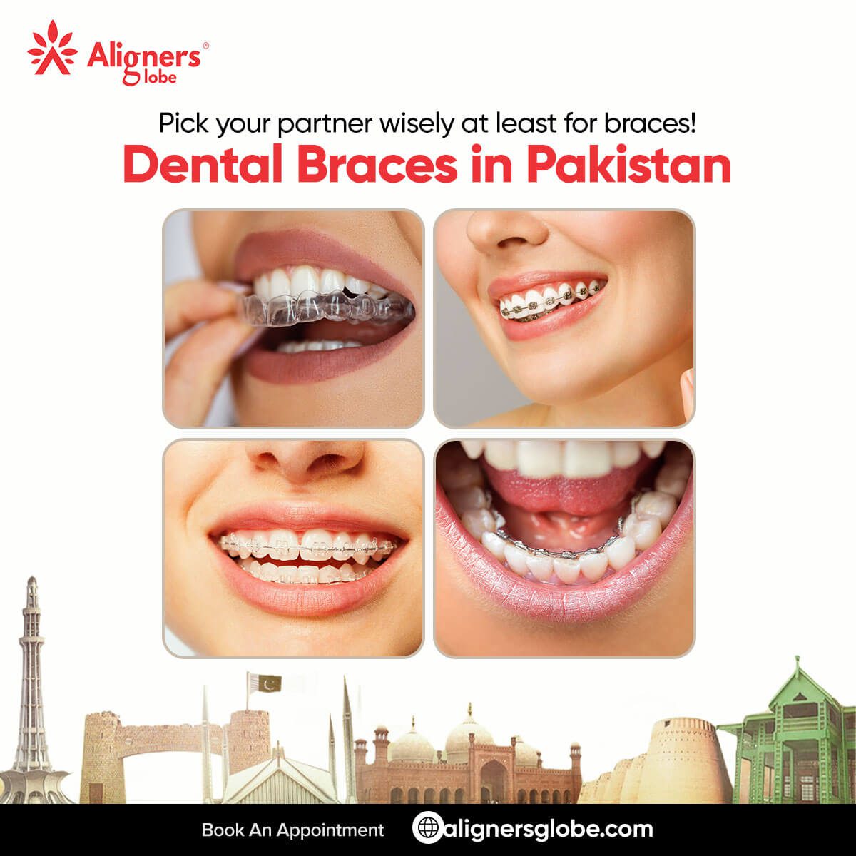 Braces Price in Pakistan Aligners price in Pakistan Aligners Globe