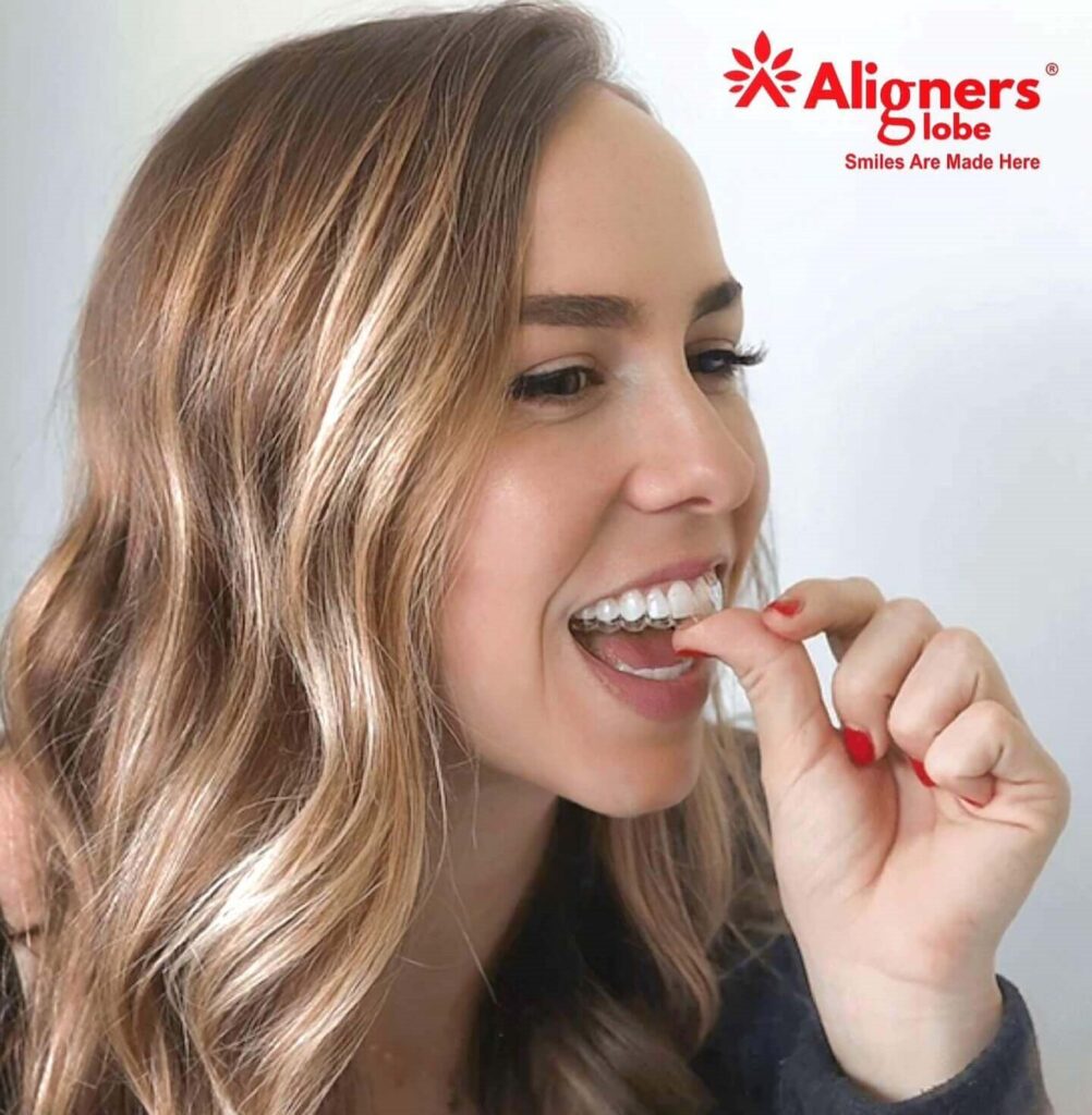 Teeth aligners