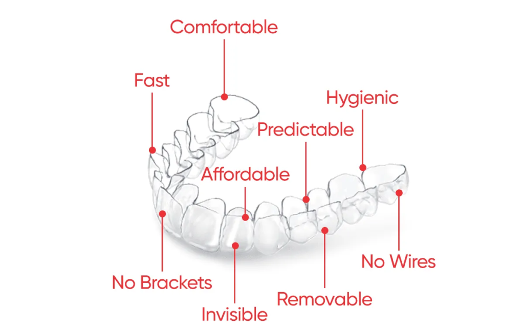 Affordable clear aligners and transparent braces in Pakistan