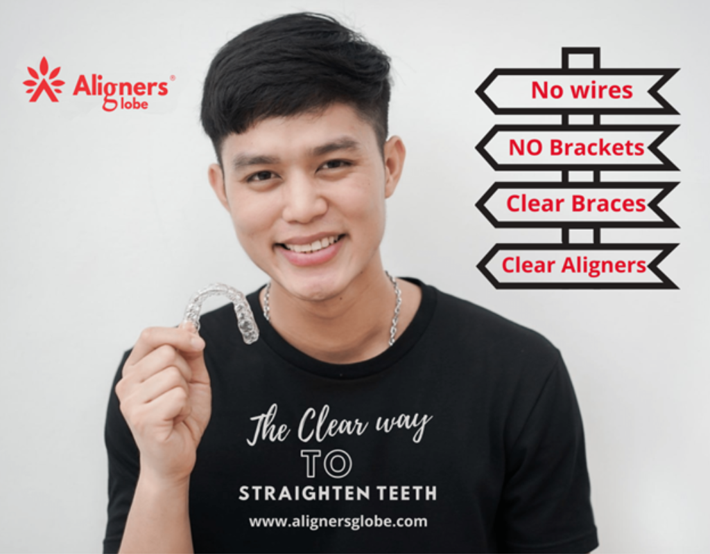 Invisible braces in Islamabad