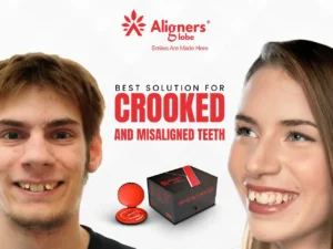 Aligners Globe – Best Solution for Crooked and Misaligned Teeth