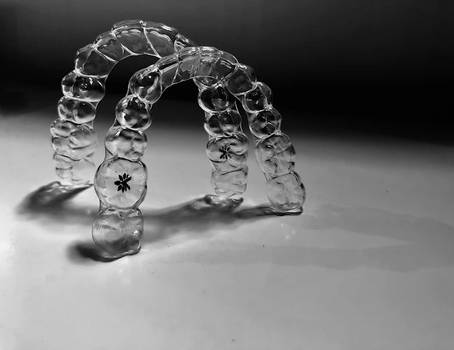 Why Clear Aligners Are the Future of Orthodontics: Benefits and Considerations
