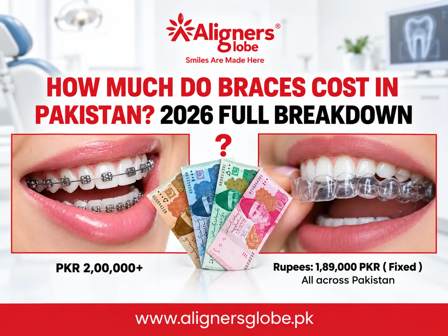 Affordable Invisible braces in Pakistan