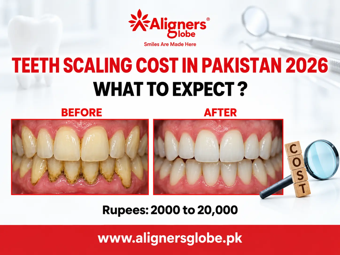 Teeth Scaling Cost in Pakistan
