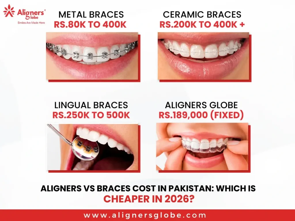 Aligners vs Braces Cost in Pakistan: Which Is Cheaper in 2026?