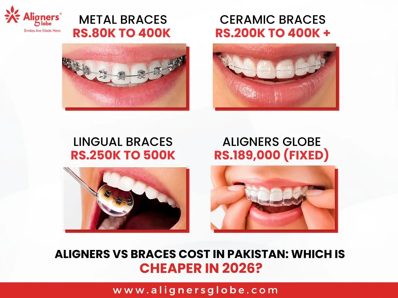 Aligners vs Braces Cost in Pakistan: Which Is Cheaper in 2026?