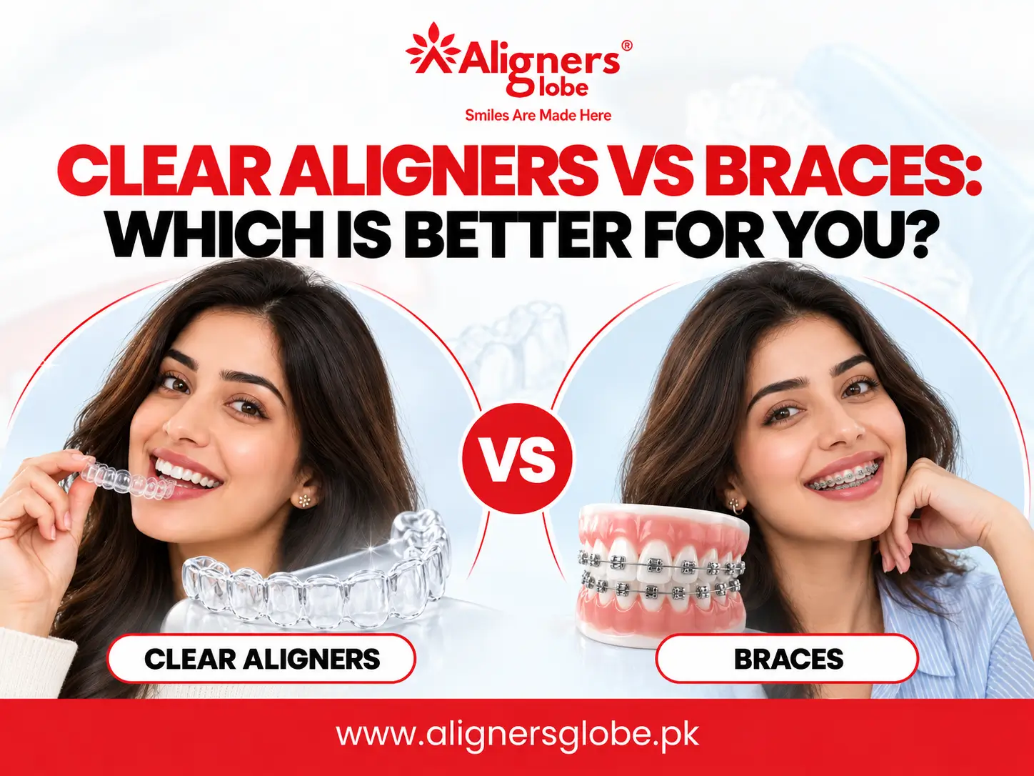 Clear Aligners vs Braces: Which Is Better for You?